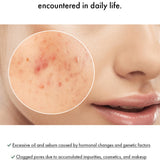 Dr. Ceuracle Vegan BHA & Matcha Ampoule