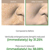 VT Cosmetics Reedle Shot 100