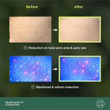 Anua Heartleaf 77% Clear Pad