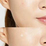 Cosrx Acne Pimple Master Patch