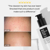 Cosrx BHA Blackhead Power Liquid