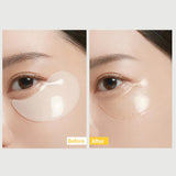MediAnswer Vita Collagen Eye Cream Patch
